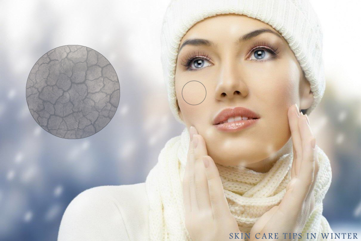 Keeping your Skin Healthy in the Winter